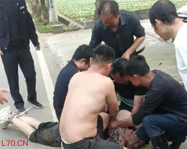 被咬掉鼻老人称再遇到还会挺身而出